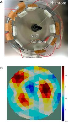 Past, present, and future of electrical impedance tomography and myography for medical applications: a scoping review